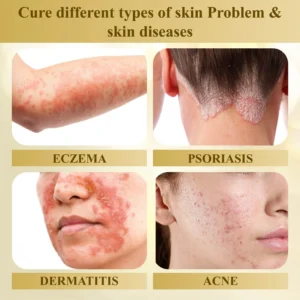 Condense Mellifera Venom Skin Repairing Cream - Image 13