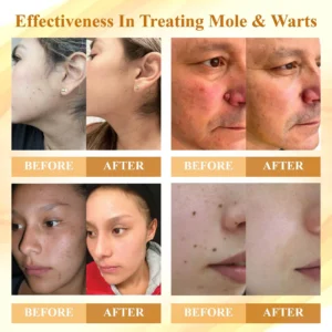 Condense Mellifera Venom Skin Repairing Cream - Image 2
