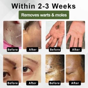 Skin Clear Herbal Jelly Gel - Image 2
