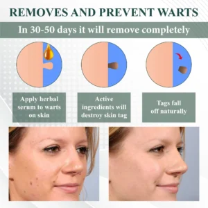 Skin Clear Herbal Jelly Gel - Image 7