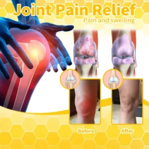 Bee Venom & Turmeric Arthritis Therapy Cream - Image 15