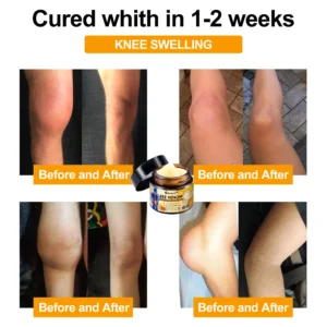 Bee Venom Advanced Joint and Bone Therapy Cream - Image 4
