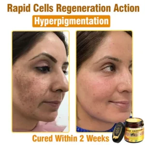 𝐁𝐞𝐞 𝐕𝐞𝐧𝐨𝐦 𝐀𝐥𝐥-𝐢𝐧-𝐎𝐧𝐞 𝐂𝐫𝐞𝐚𝐦–Anti-Aging, Hydrating & Skin Repair - Image 10