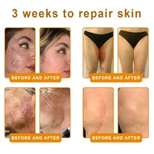 𝐁𝐞𝐞 𝐕𝐞𝐧𝐨𝐦 𝐀𝐥𝐥-𝐢𝐧-𝐎𝐧𝐞 𝐂𝐫𝐞𝐚𝐦–Anti-Aging, Hydrating & Skin Repair - Image 4