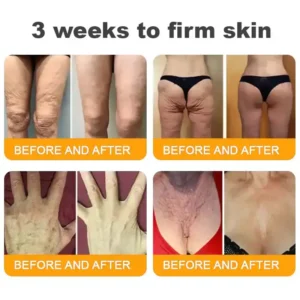 𝐁𝐞𝐞 𝐕𝐞𝐧𝐨𝐦 𝐀𝐥𝐥-𝐢𝐧-𝐎𝐧𝐞 𝐂𝐫𝐞𝐚𝐦–Anti-Aging, Hydrating & Skin Repair - Image 7