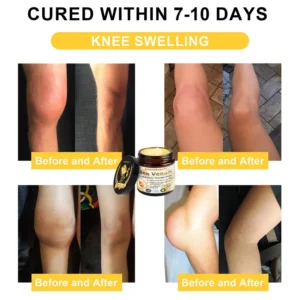 Bee Venom Joint and Bone Arthritis Therapy Cream - Image 4