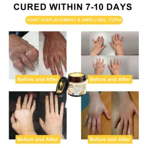 Bee Venom Joint and Bone Arthritis Therapy Cream - Image 5
