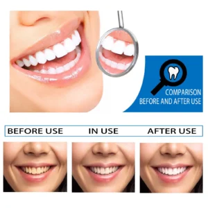 Teeth Essence Liquid - Image 4