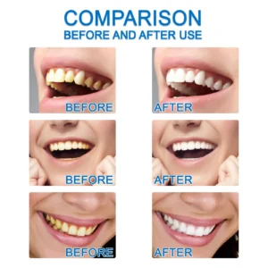 Teeth Essence Liquid - Image 5