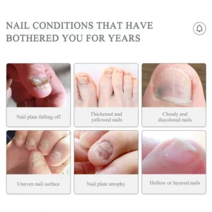 Nail Treatment Serum Pen - Image 6