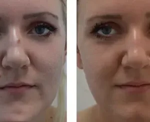 Bee Venom Skin Treatment Cream - Image 2