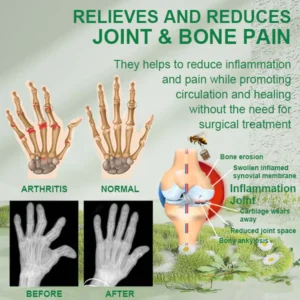 New Zealand Bee Venom Joint and Bone Therapy Cream - Image 3