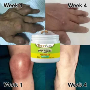 New Zealand Bee Venom Joint and Bone Therapy Cream - Image 6