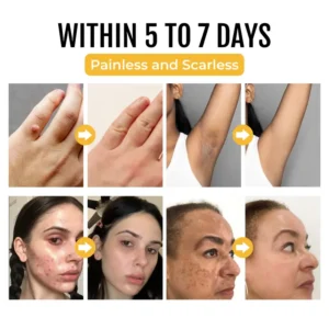 PapilloClear Bee Venom Skin Treatment Cream - Image 4