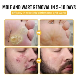 PapilloClear Bee Venom Skin Treatment Cream - Image 7