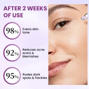 RadiantClear Blemish & Brightening Serum - Image 5