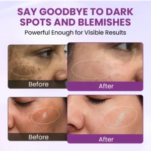 RadiantClear Blemish & Brightening Serum - Image 8