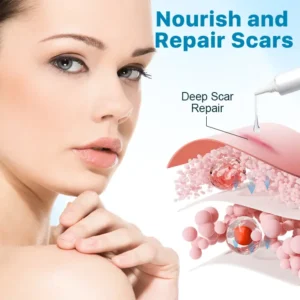 Silicone Anti-Scar Cream - Image 5