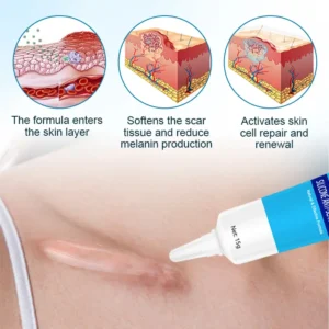 Silicone Anti-Scar Cream - Image 6