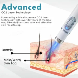 PRO Non-Invasive Mole and Wart Removal Laser Pen - Image 6