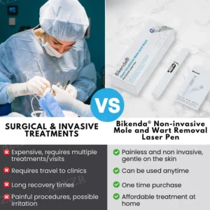 PRO Non-Invasive Mole and Wart Removal Laser Pen - Image 8