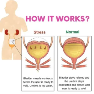 Bladder Control Patch - Image 6