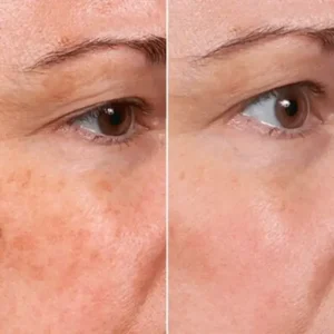 ️ 𝐒𝐭𝐞𝐦 𝐂𝐞𝐥𝐥–𝐈𝐧𝐬𝐩𝐢𝐫𝐞𝐝 &Blue Copper Peptide 𝐖𝐫𝐢𝐧𝐤𝐥𝐞-𝐑𝐞𝐟𝐢𝐧𝐢𝐧𝐠 𝐒𝐞𝐫𝐮𝐦 - Image 10