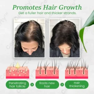 ReGenix Hair Growth Serum - Image 4