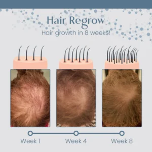 Root Renew Nourishing Hair Scrub - Image 5