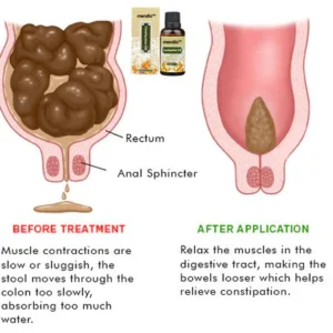 Constipation Oil - Image 4
