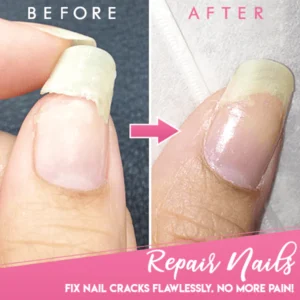 Cracked Nail Repair Gel - Image 2