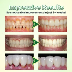 Propolis Oral Health Spray - Image 2