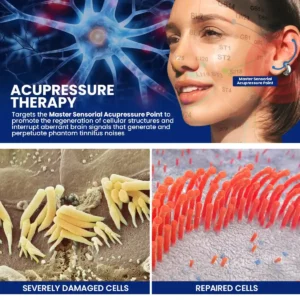 Acupressure Tinnitus Relief Earring - Image 3