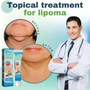 Lipoma Removal Cream - Image 3