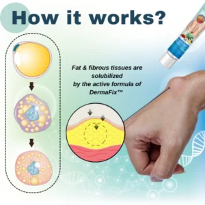 Lipoma Removal Cream - Image 5