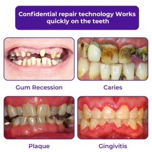 Dental Repair Mineral Powder - Image 2