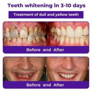 Dental Repair Mineral Powder - Image 3