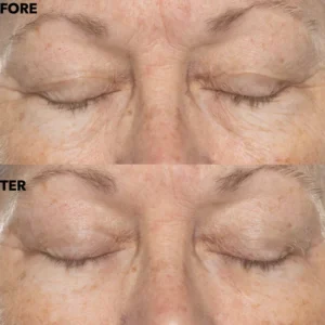 Double Retinol & Collagen Peptide Serum Treatment - Image 4