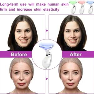 EMS FACE LIFTING MASSAGER - Image 3