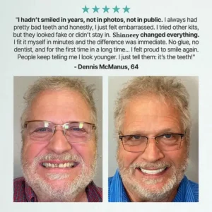 Custom-Fit Full Functional Dentures - Image 11