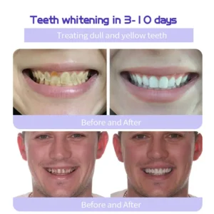 Fluoride-Free Hydroxyapatite Toothpaste - Image 10