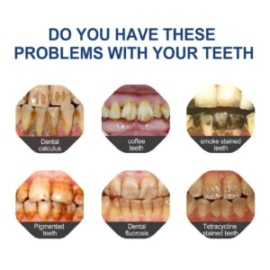 Fluoride-Free Hydroxyapatite Toothpaste - Image 3