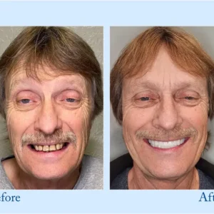 Fluoride-Free Hydroxyapatite Toothpaste - Image 6