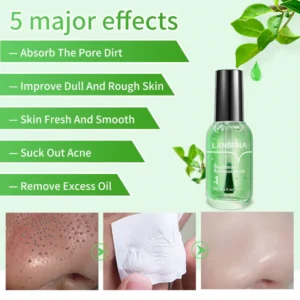 Facial Essence Blackhead Removal Kit - Image 3