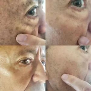 Melanin Correcting Facial Serum - Image 6