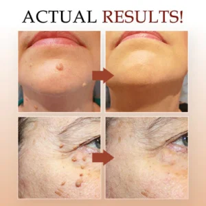Tags & Moles Remover - Image 6