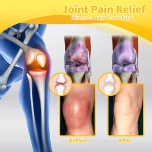 Bee-Venom Pain-Relief Bone Healing Cream - Image 8