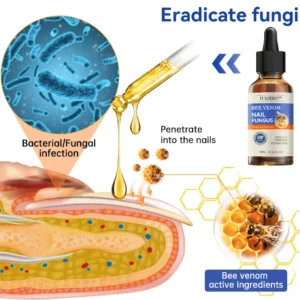 Bee Venom Nail Fungus Treatment Cream - Image 3