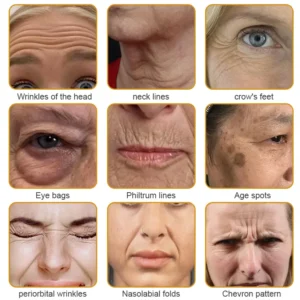 Botox Bee Venom Wrinkle Removal Cream - Image 13
