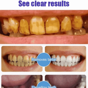 SP-6 Probiotic Ultra Whitening Toothpaste - Image 3